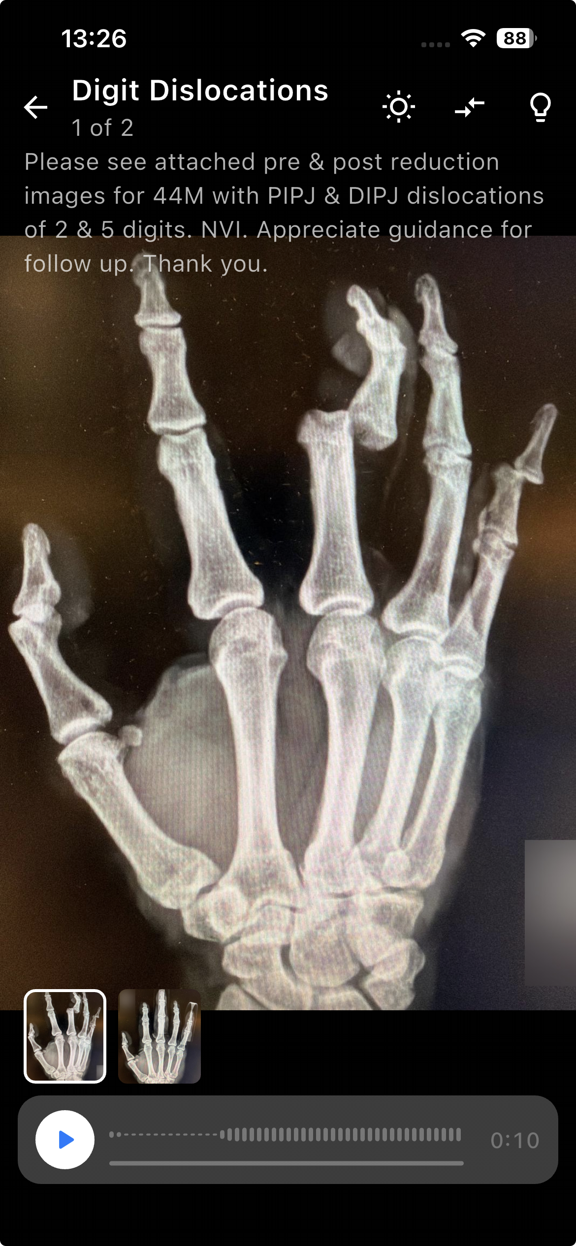 Clinical case detail view with voice note