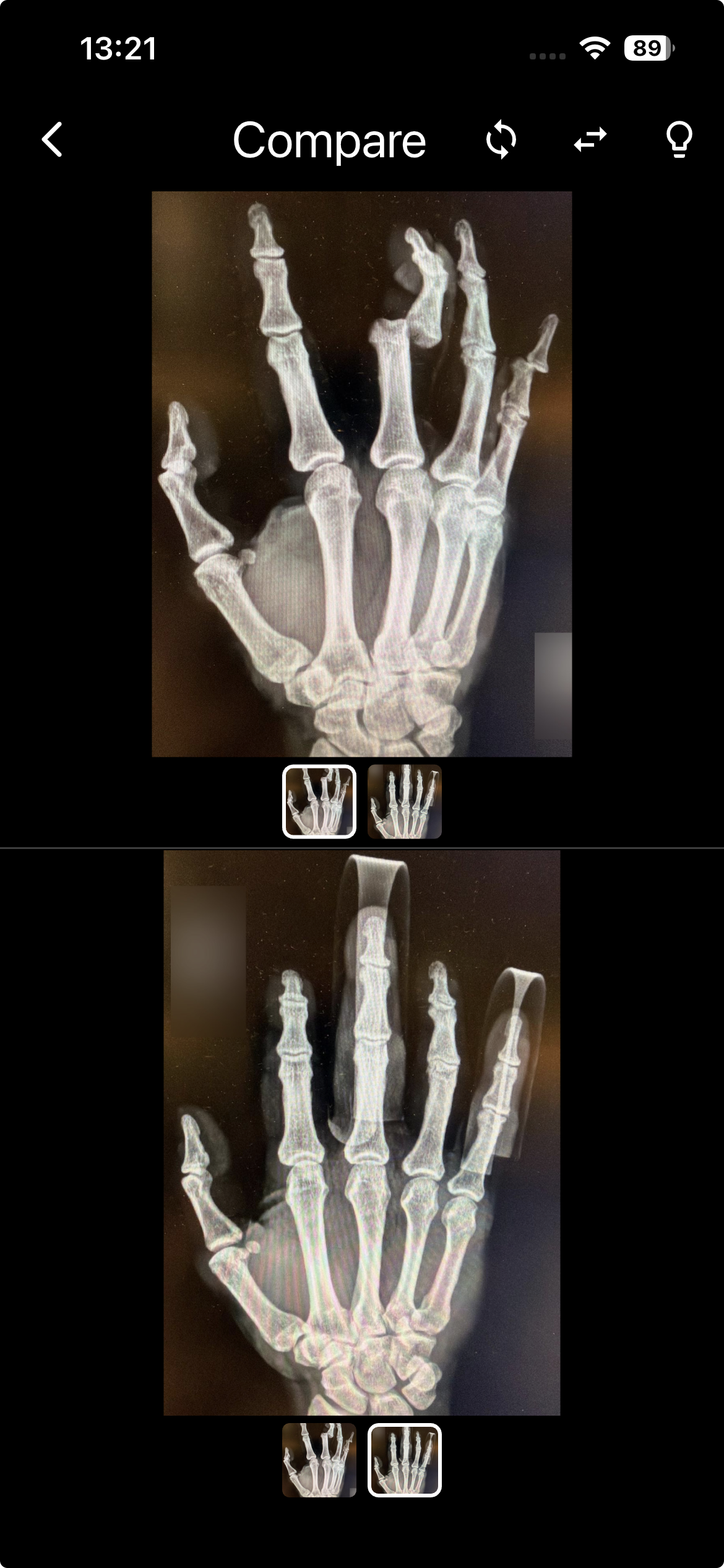Side-by-side image compare mode with synchronised zoom